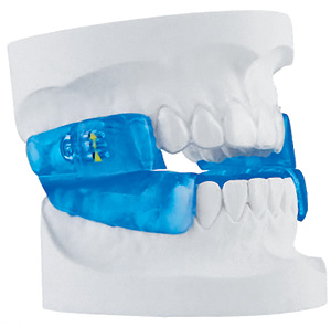 Sleep Apnea Treatment